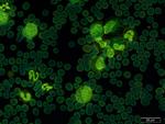 Diagnosing Leukemia in a Hedgehog by Karl Snyder